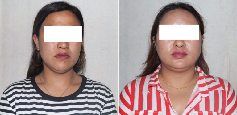 हनी ट्रयापमा सरकारी कर्मचारी, काठमाडौंमा घर-जग्गा बार्गेनिङ